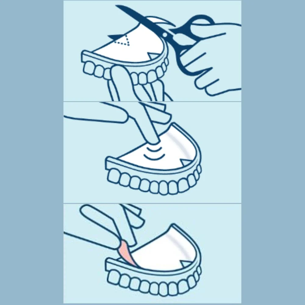 Algasiv Pads for Superior and Inferior Denture