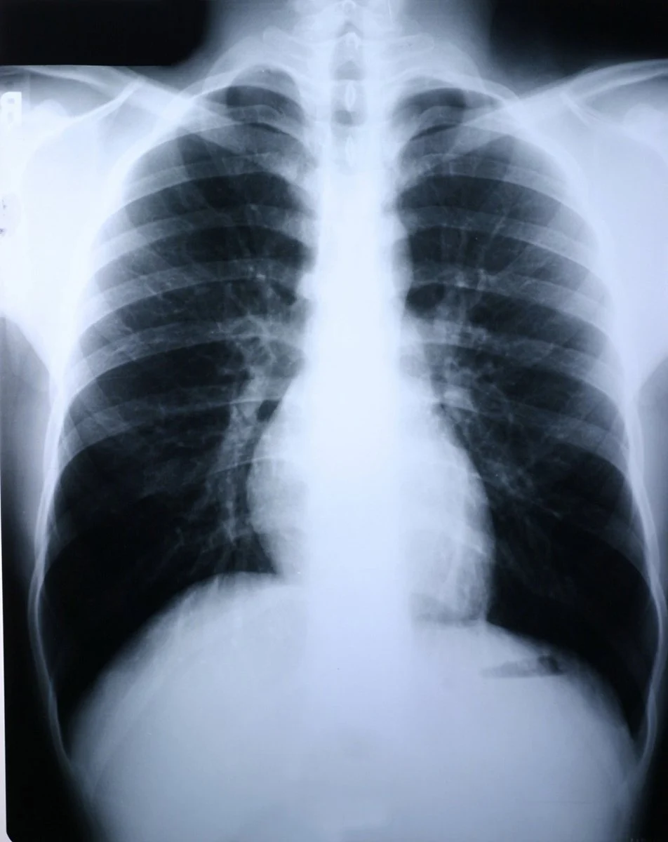 Clear Choice Performance X Ray Film