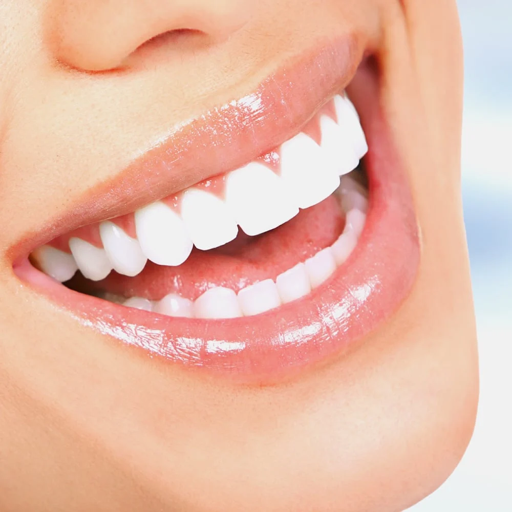Colgate Duraphat 5000
