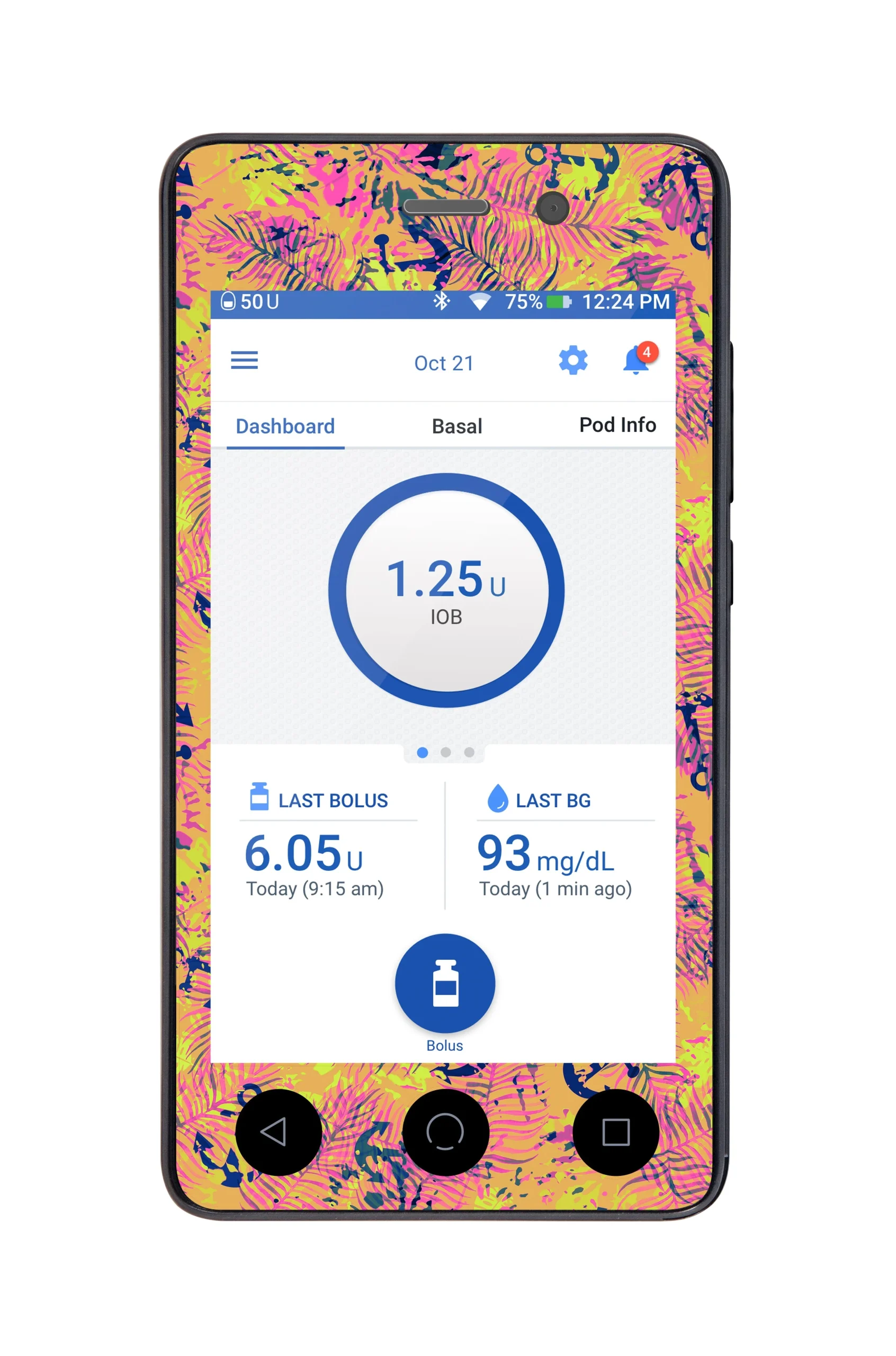 Electric IslandSticker for Omnipod DASH PDM – Pump Peelz