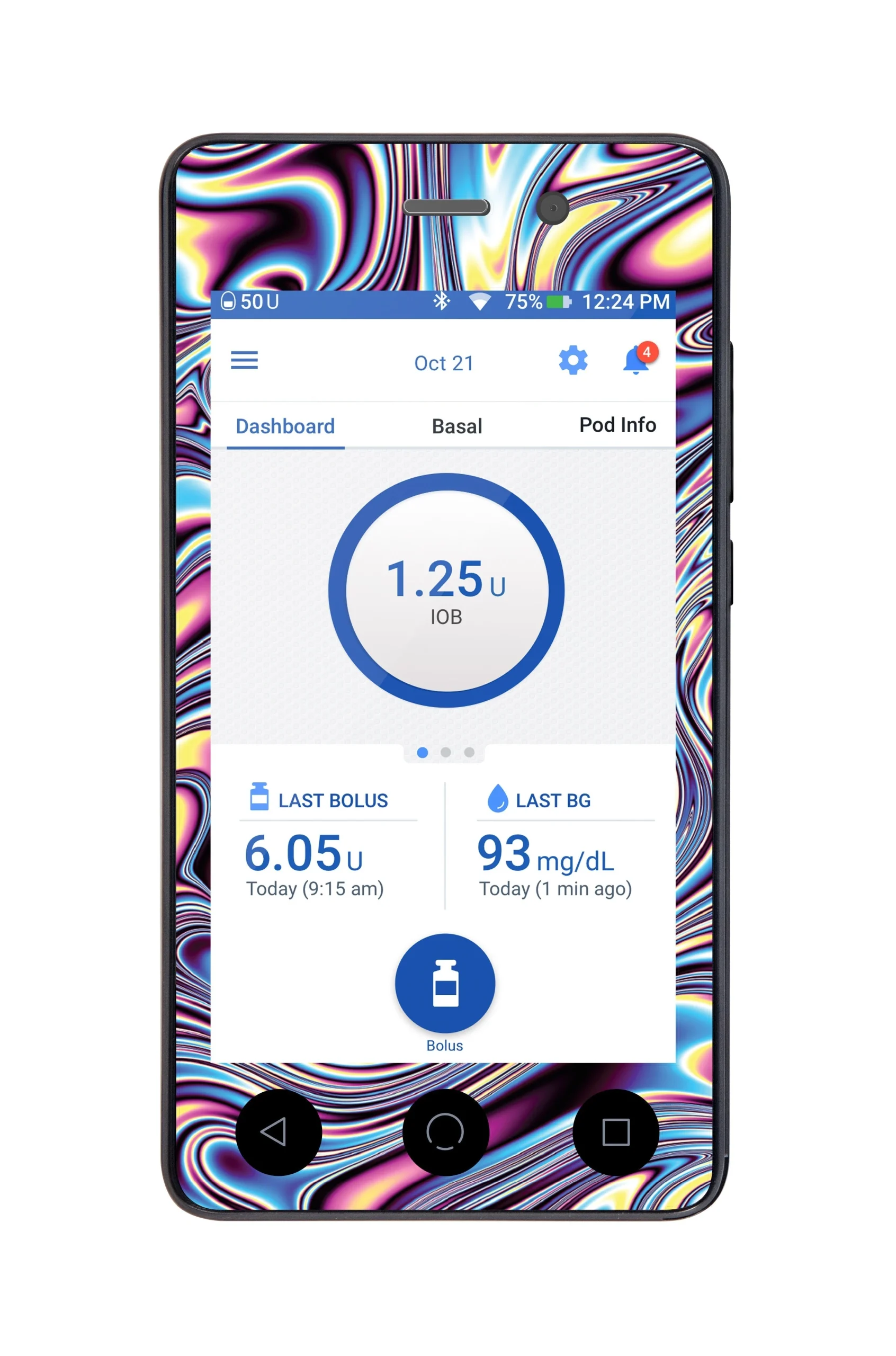 Liquid Metal Sticker for Omnipod DASH PDM – Pump Peelz